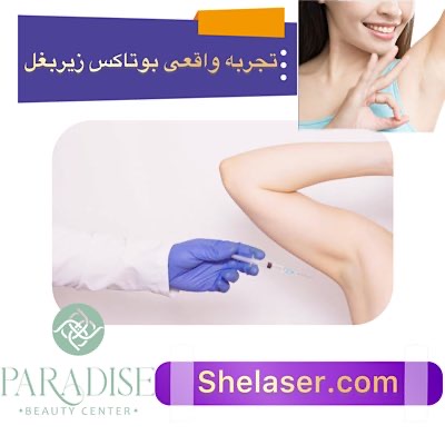 تجربه واقعی بوتاکس زیر بغل