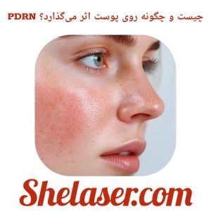 PDRN چیست و چگونه روی پوست اثر می‌گذارد؟