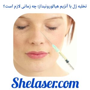 تخلیه ژل با آنزیم هیالورونیداز؛ چه زمانی لازم است؟