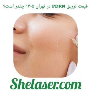قیمت تزریق PDRN در تهران ۱۴۰۵ چقدر است؟