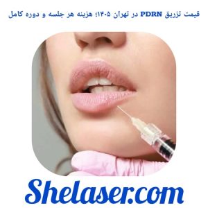 قیمت تزریق PDRN در تهران ۱۴۰۵؛ هزینه هر جلسه و دوره کامل