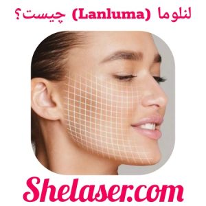 لنلوما (Lanluma) چیست؟