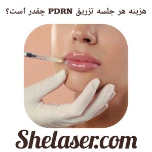 هزینه هر جلسه تزریق PDRN چقدر است؟