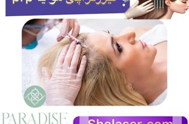 لیزر تراپی مو یا PRP