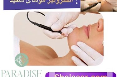 الکترولیز موهای سفید