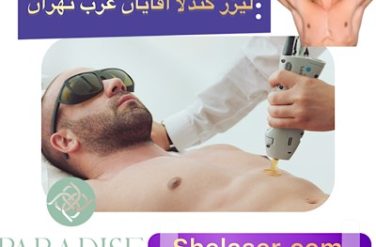 لیزر کندلا آقایان غرب تهران