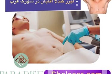 لیزر کندلا آقایان در شهرک غرب