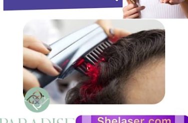 درمان ریزش مو با لیزر
